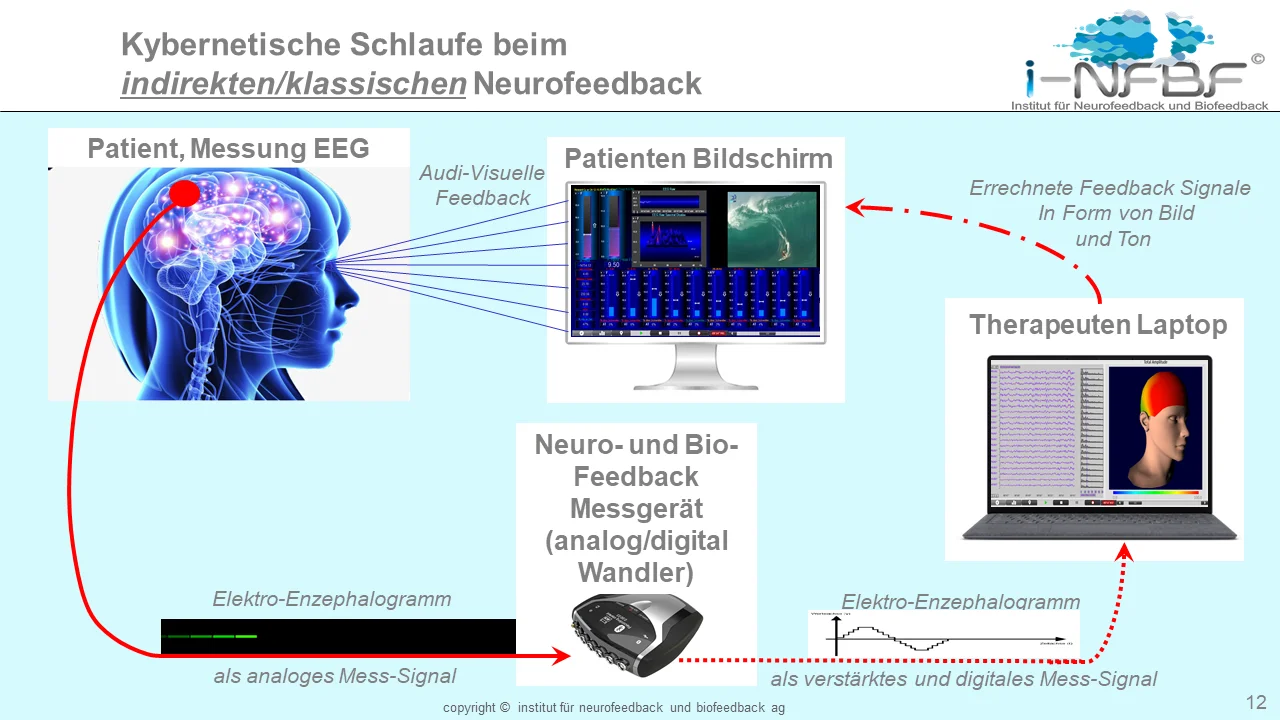 Neurofeedback session